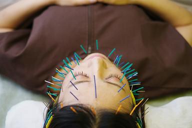 美容鍼60分＋身体鍼30分（通常12,500円）