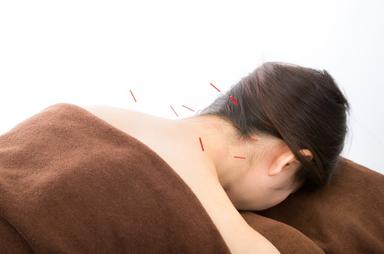 【自律神経ケア鍼】不眠・疲労感・ストレスによる不調に◎ 60分 通常料金7,800円