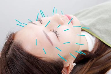 リフトアップ美容鍼　60分