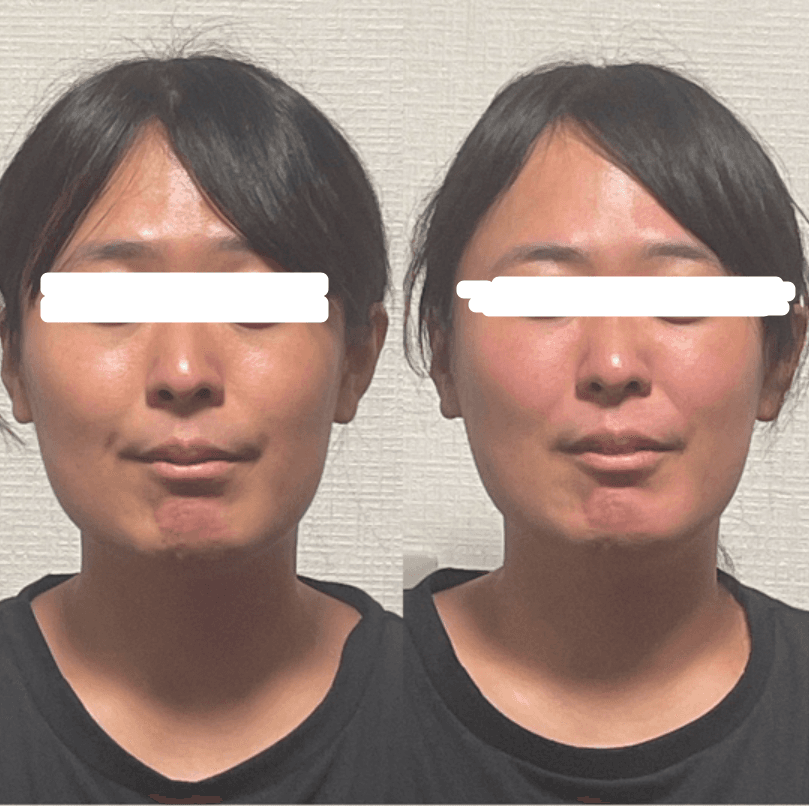 【定番の充実ケア】全身オイルリンパ50分×小顔美整40分★バランス良くケア
