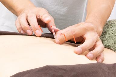 《新規》鍼灸施術40分【体の痛みやしびれ、動かしづらさに】初回料金5,000円→
