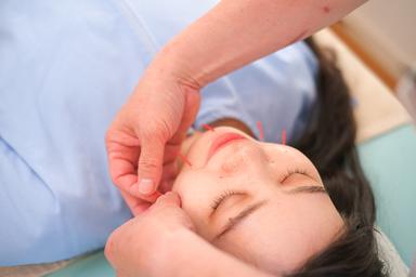 Cosmetic acupuncture 90分