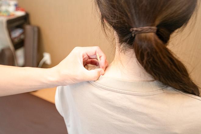 【初回限定】【肩の痛みを改善したい方へ整体と姿勢学習と針コース】整体×姿勢×針/ 80分 通常料金10,000円