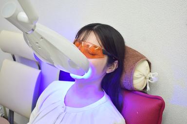 ベネホワイトニング 75分