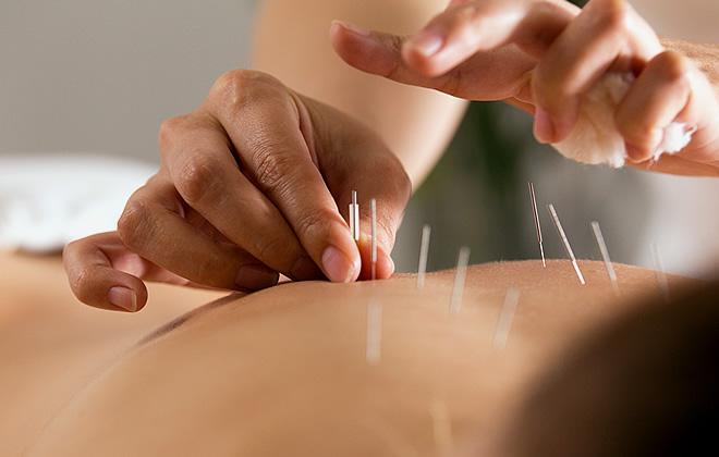 Japanese Acupuncture Therapy 60分