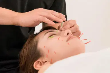Japanese Facial Acupuncture & Facial massage – 90 min