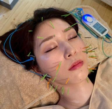 【新規限定】美容鍼＆ヘッドor電気鍼体験コース ９０分コース通常料金16,500円