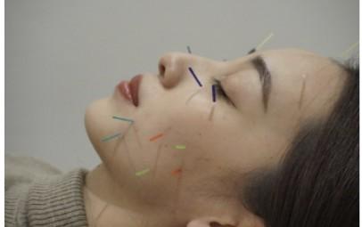 美顔はり　～本質改善できめ細かお肌へ～