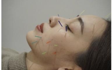 美顔はり　～本質改善できめ細かお肌へ～