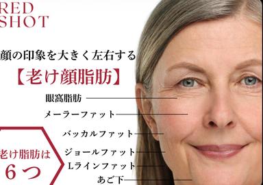【REDショット】目の下の脂肪・たるみ・クマに徹底アプローチ