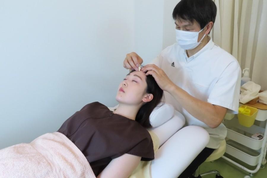 美容鍼50分