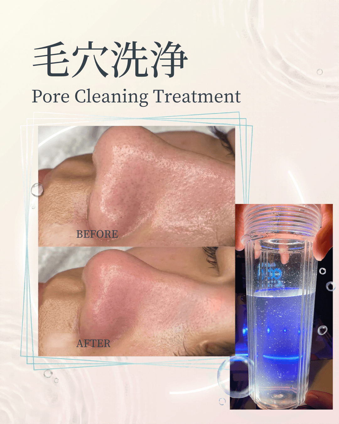 【通常9,800円→7,800円】毛穴洗浄＋CICA美容液パック 60分　