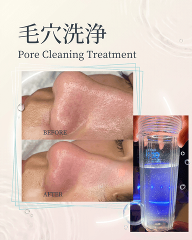 【通常9,800円→7,800円】毛穴洗浄＋CICA美容液パック 60分　