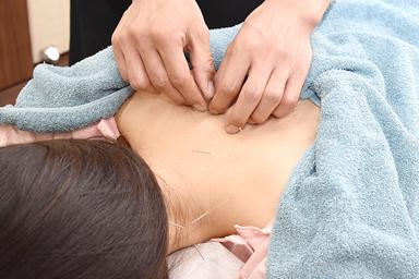 局部施術（つらいところ）40分　