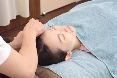 cosmetic acupuncture＋whole body care 90分　