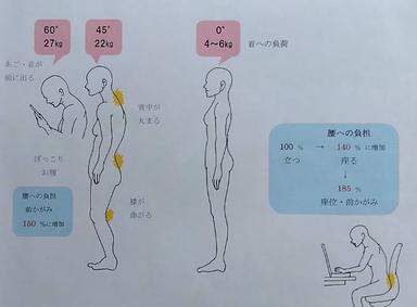 シャキッ！と【猫背改善・お尻引き上げ】ﾄﾚｰﾆﾝｸﾞ《初回(問診含む)90分》  圧痛・動作確認 → 運動