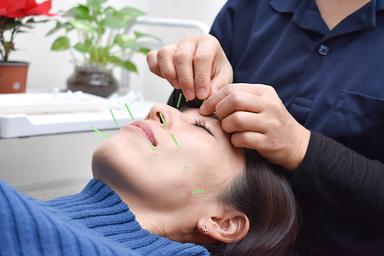 美容鍼コース 40分