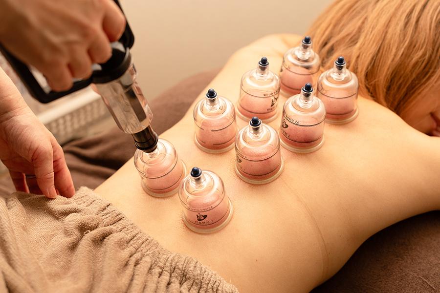 カッピング15分