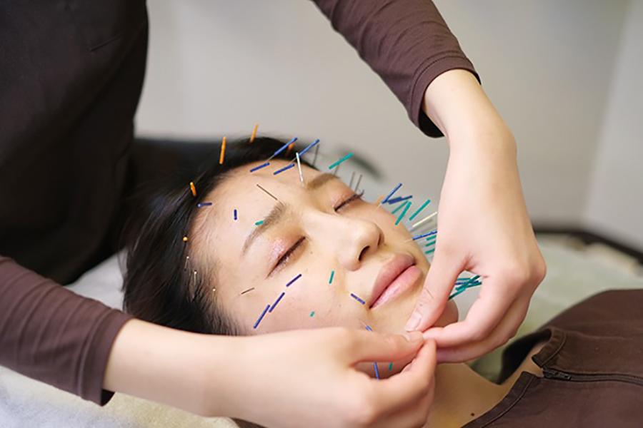 美容鍼60分＋もみほぐし30分