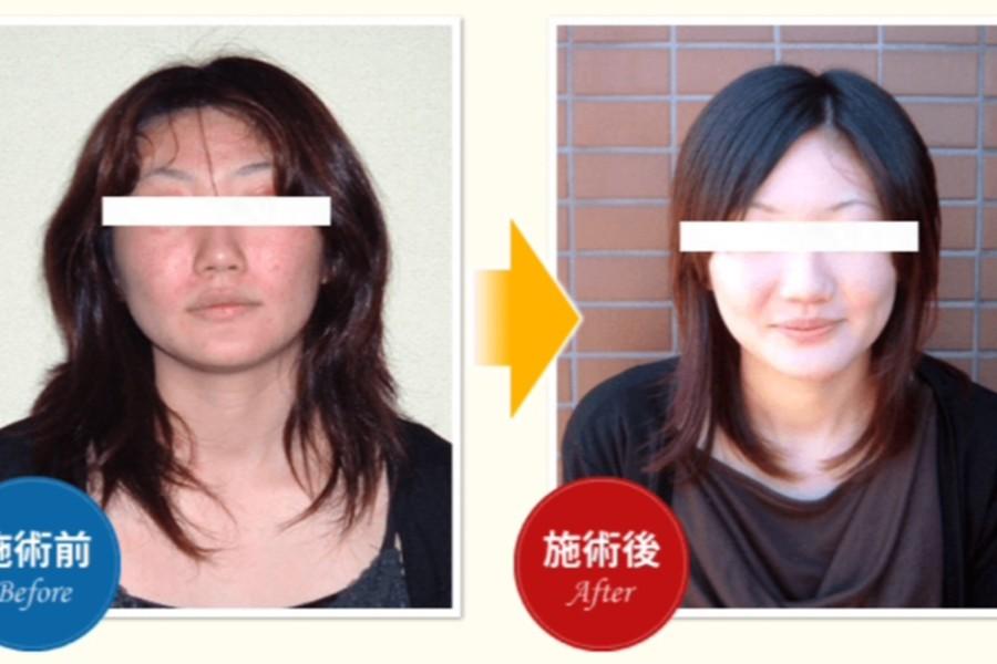 アトピー・アレルギー整体 45分（カウンセリング含む）￥11000