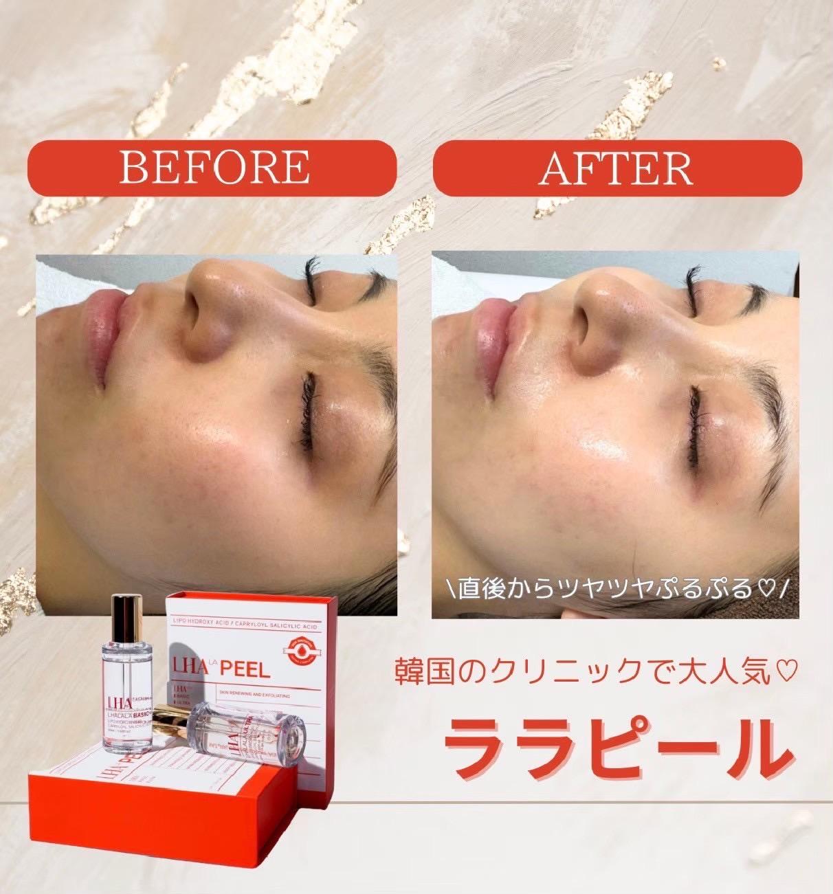 お誕生日の方限定　ララピール