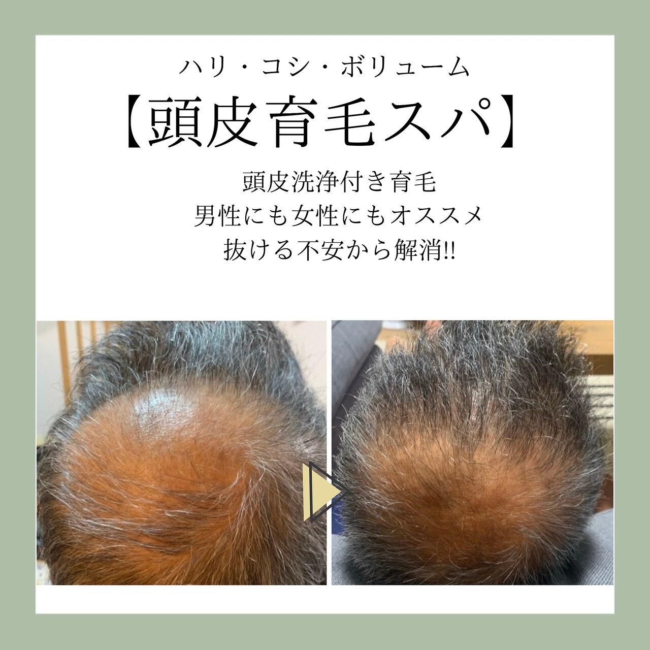 育毛促進ヘッドスパ
