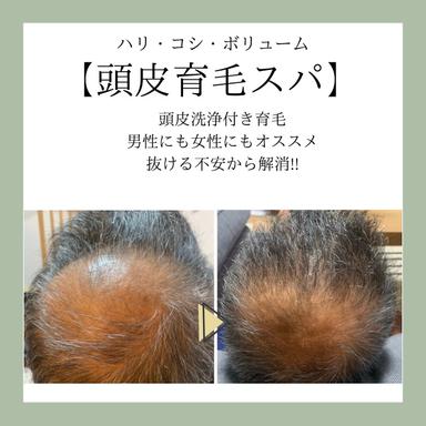 育毛促進ヘッドスパ