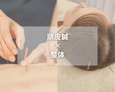 《SETクーポン》ボディ鍼＋頭皮鍼◎身体の疲れ×目の疲れ解消！¥7800