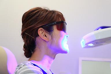 セルフホワイトニング(スタンダード)30分
