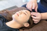 ≪お顔と体の疲れが気になる方≫ 指圧ボディケア60分+美容鍼+小顔調整 