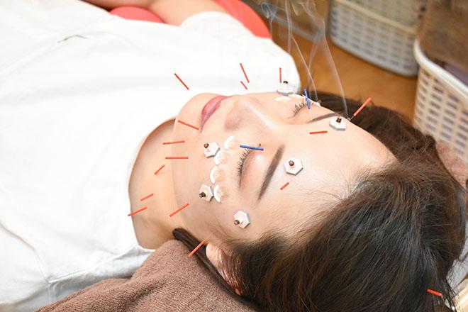 美容鍼灸スペシャルコース(レギュラーコース＋選べるオプション30分）約60分