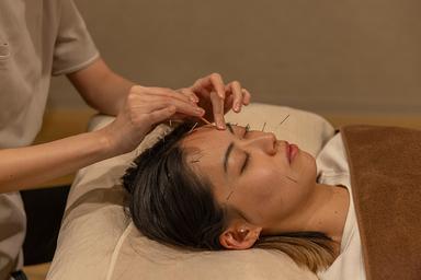 美顔鍼+フットorヘッド 70分