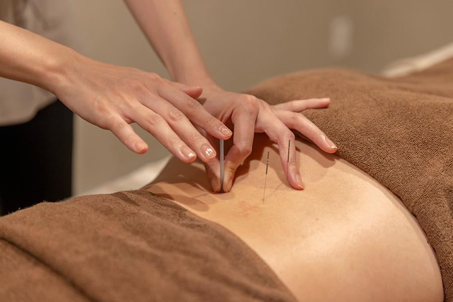 整体＋鍼灸 100分