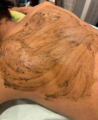 【初回】ハーブピーリング(剥離タイプ) 背中