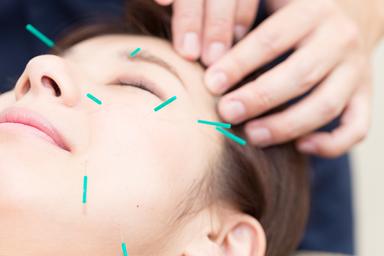 ☆整体30+カジュアル美容鍼