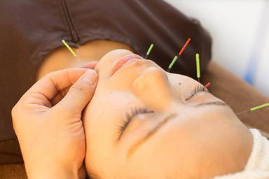 美容鍼　65分　（お顔の鍼＋首肩・手足の鍼灸施術）
