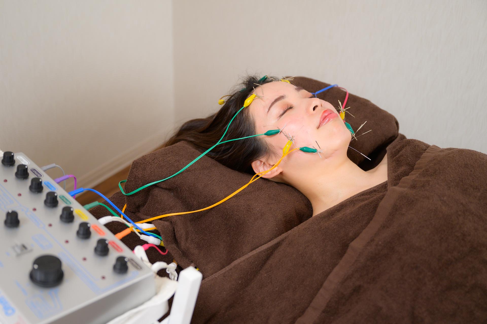 ★新メニュー★新規限定♪エラ・食いしばり撃退♪小顔美容鍼♪ 【院長施術】