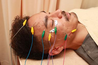 【新規限定】<目の疲れや頭が重く疲れてる方に>メンズ美容鍼（※初診料込み）90分 通常13,200円