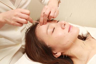 アンチエイジング美容鍼 （50本以上の鍼を使用！60分）