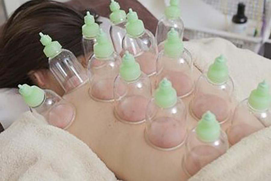 【回数券お持ちの方】カッピング（上半身もしくは下半身）