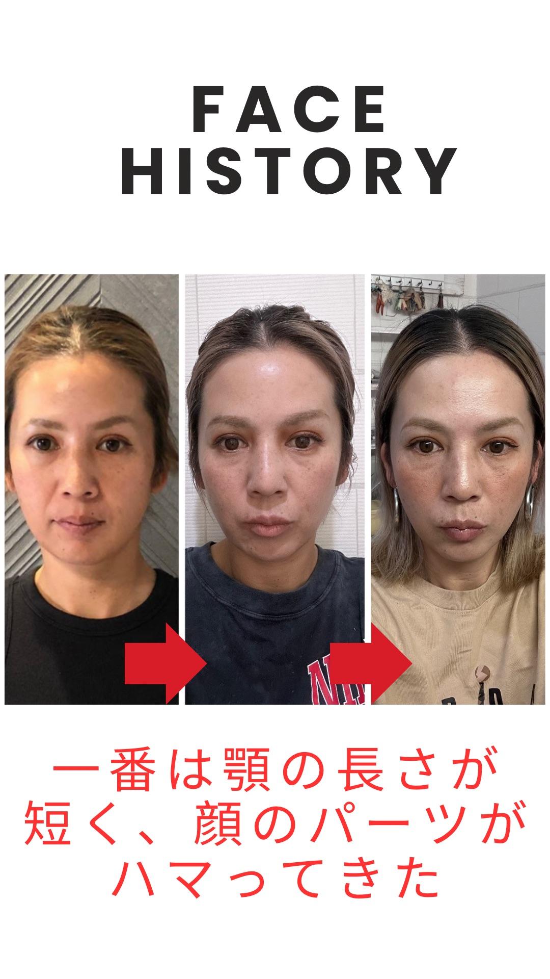 (お試し新規限定）本格６０分！顎、噛み合わせ、シワたるみ二重顎改善！本格小顔矯正