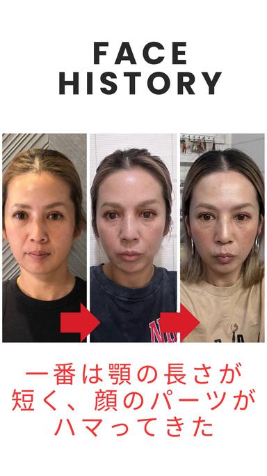 (お試し新規限定）本格６０分！顎、噛み合わせ、シワたるみ二重顎改善！本格小顔矯正