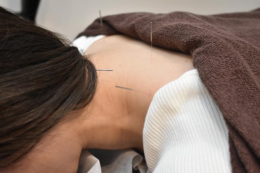 【2回目特典】頑固なコリ・疲れ対策！鍼灸マッサージ 40分 