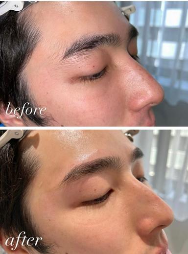 【セット割】眉wax&ヒゲ全体脱毛 60分
