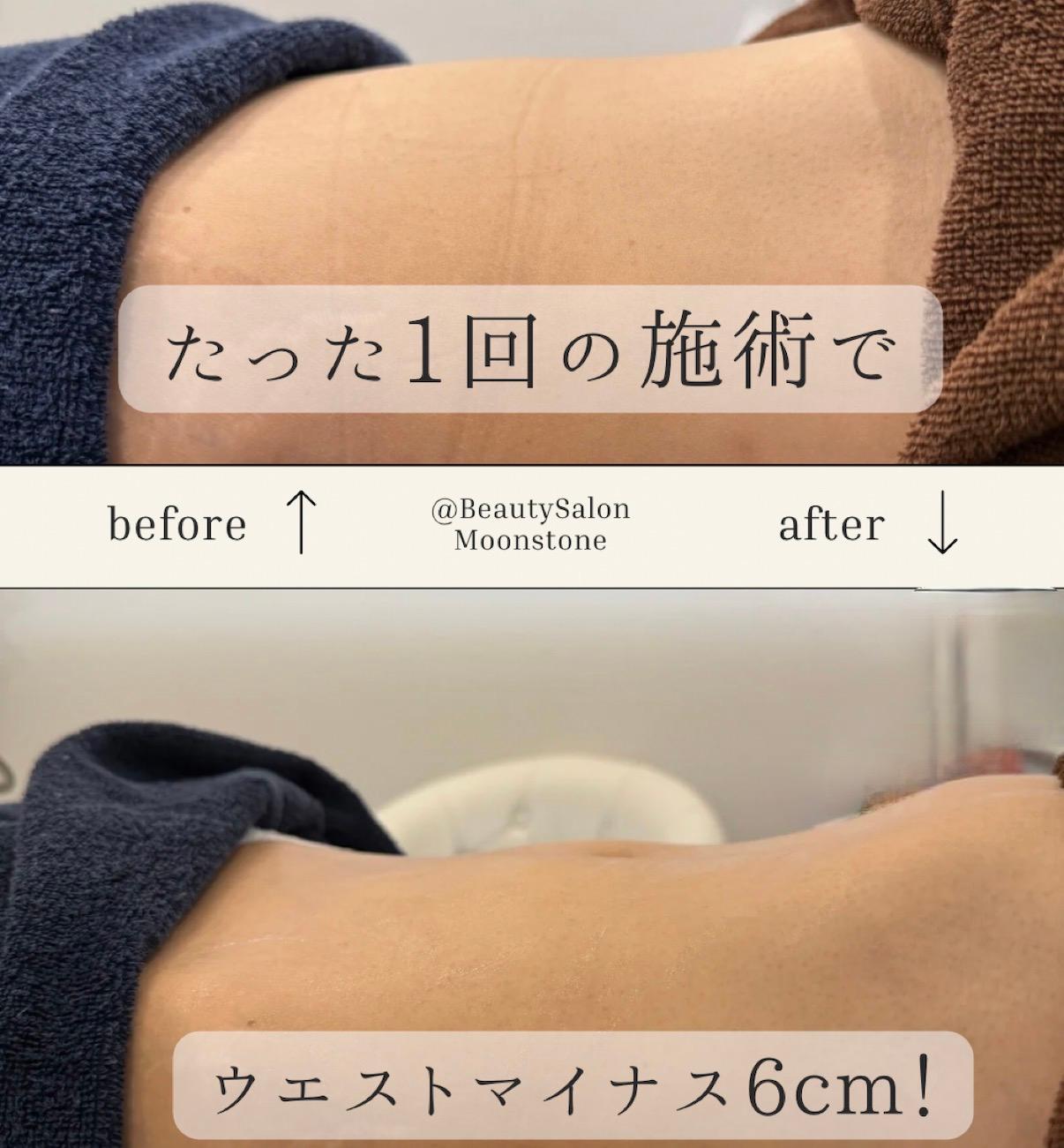 腸から痩せる！腸セラピー