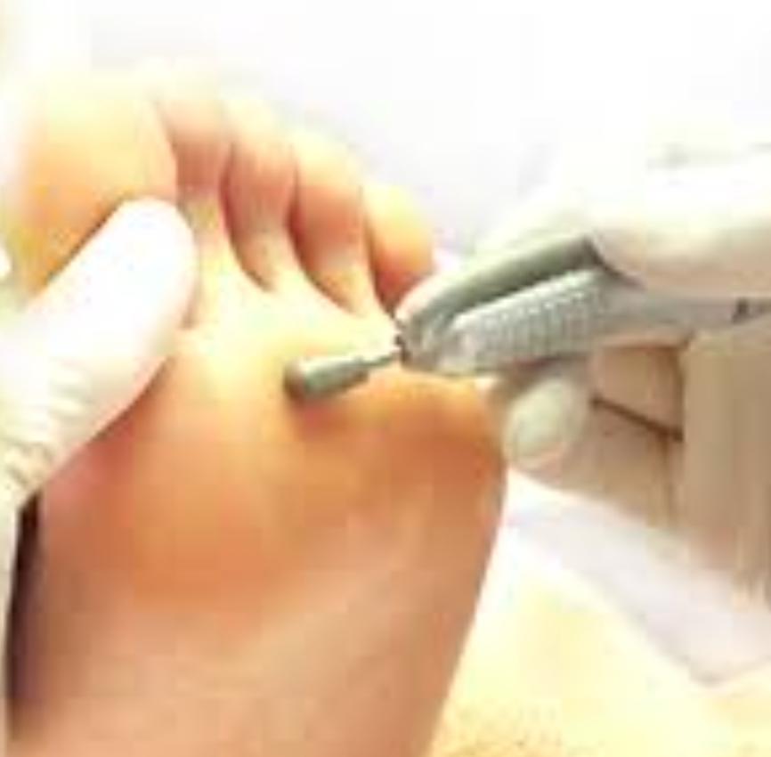 【初めて】角質ケア45分　通常5,750円