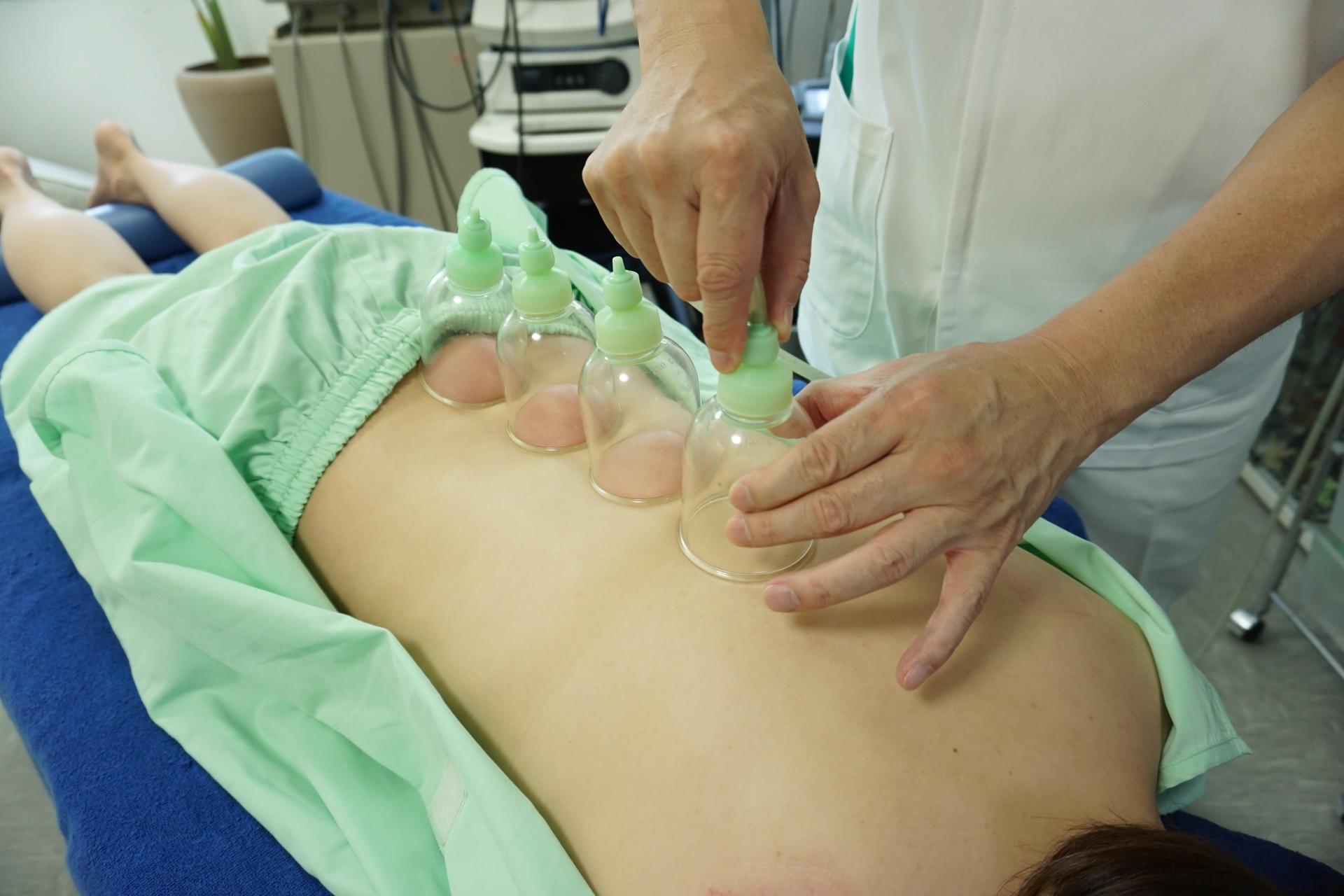 院長お任せカッピング 25分