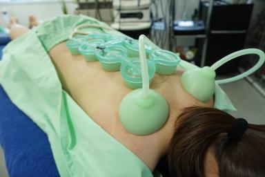 【新規限定】院長お任せカッピング 50分