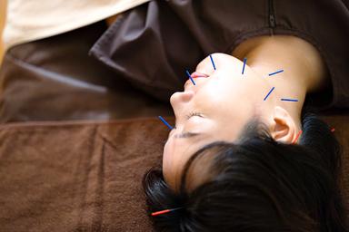 【新規限定】お試し！美容鍼灸(お顔＋体)＋ヘッドマッサージ付き 60分