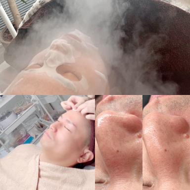細胞から若々しく♪幹細胞培養上清液クイックコース＋毛穴洗浄（Tゾーンのみ） 70分